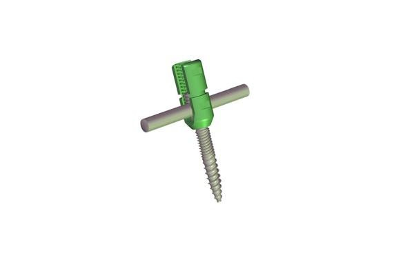 Reduction screw  5.5 MM 